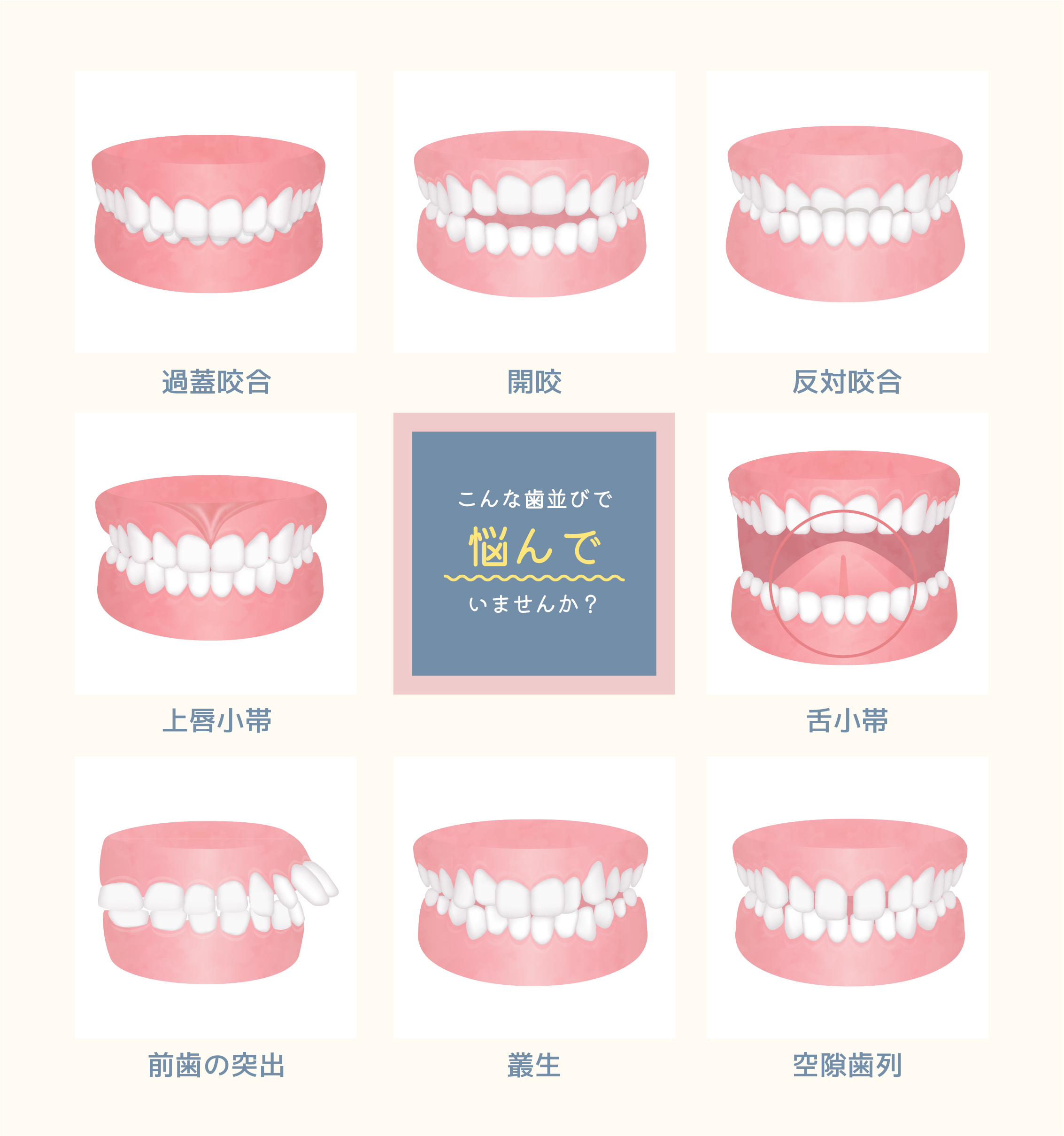 こんな歯並びで悩んでいませんか?