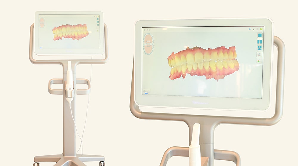 3D光学スキャナーで印象取りも簡単
